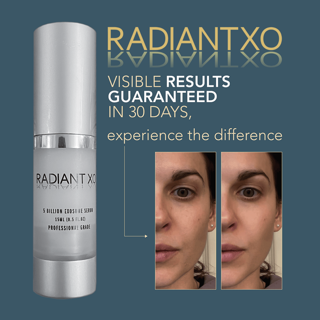RadiantXO skincare serum with before and after results on a blue background