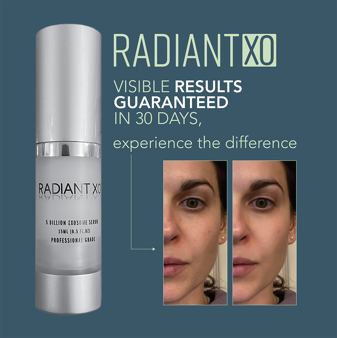 RadiantXO Serum